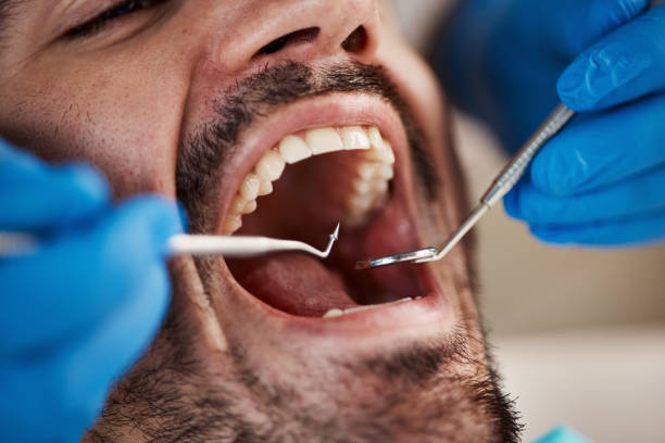 Best Emergency Tooth Extraction in St City, AR