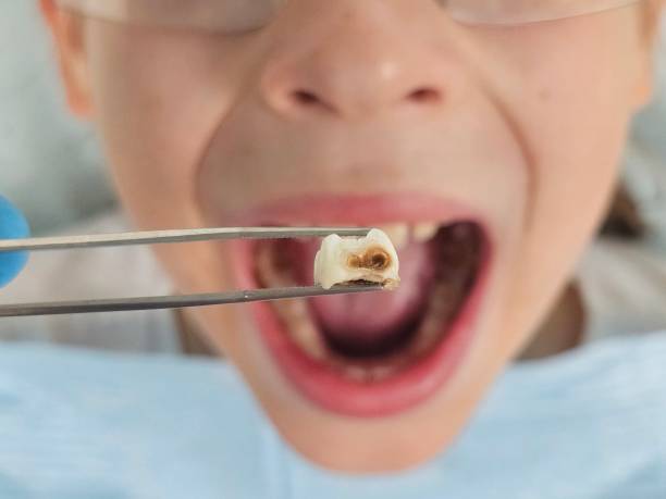 Best Urgent Care for Lost Fillings or Crowns in St City, AR