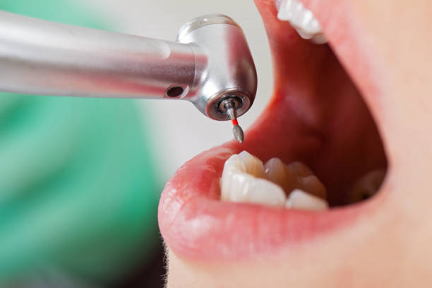  St City, AR Emergency Dentist Pros